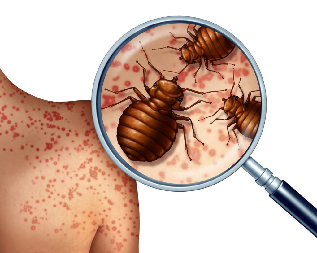 bed bugs illustration